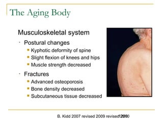 B. Kidd 2007 revised 2009 revised 20101200
The Aging Body
Musculoskeletal system
• Postural changes
 Kyphotic deformity of spine
 Slight flexion of knees and hips
 Muscle strength decreased
• Fractures
 Advanced osteoporosis
 Bone density decreased
 Subcutaneous tissue decreased
1200Trauma in Elderly -
 
