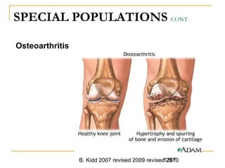 B. Kidd 2007 revised 2009 revised 20101287
SPECIAL POPULATIONS CONT
Osteoarthritis
 