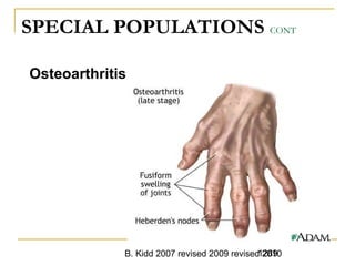 B. Kidd 2007 revised 2009 revised 20101289
SPECIAL POPULATIONS CONT
Osteoarthritis
 
