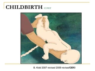 B. Kidd 2007 revised 2009 revised 20101331
CHILDBIRTH CONT
 