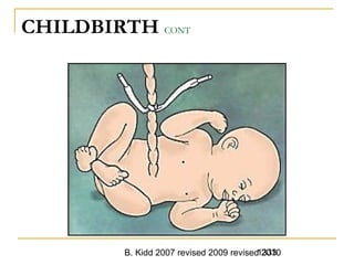 B. Kidd 2007 revised 2009 revised 20101333
CHILDBIRTH CONT
 