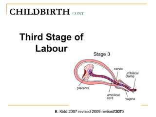 B. Kidd 2007 revised 2009 revised 20101337
CHILDBIRTH CONT
Third Stage of
Labour
 