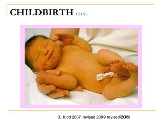 B. Kidd 2007 revised 2009 revised 20101338
CHILDBIRTH CONT
 