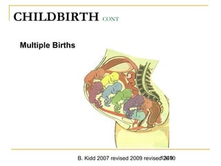 B. Kidd 2007 revised 2009 revised 20101349
CHILDBIRTH CONT
Multiple Births
 