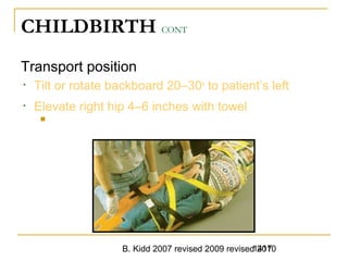 B. Kidd 2007 revised 2009 revised 20101417
CHILDBIRTH CONT
Transport position
• Tilt or rotate backboard 20–30o
to patient’s left
• Elevate right hip 4–6 inches with towel
 Manually displace uterus to left
1417Trauma in Pregnancy -
 