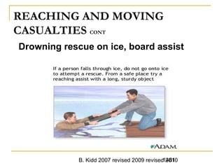 B. Kidd 2007 revised 2009 revised 20101481
REACHING AND MOVING
CASUALTIES CONT
Drowning rescue on ice, board assist
 