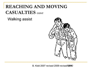 B. Kidd 2007 revised 2009 revised 20101484
REACHING AND MOVING
CASUALTIES CONT
Walking assist
 