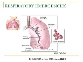 B. Kidd 2007 revised 2009 revised 2010353
RESPIRATORY EMERGENCIES
 