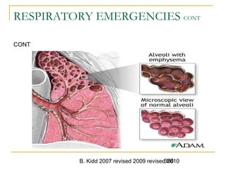 B. Kidd 2007 revised 2009 revised 2010366
RESPIRATORY EMERGENCIES CONT
CONT
 