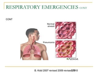B. Kidd 2007 revised 2009 revised 2010375
RESPIRATORY EMERGENCIES CONT
CONT
 