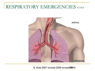 B. Kidd 2007 revised 2009 revised 2010399
RESPIRATORY EMERGENCIES CONT
 