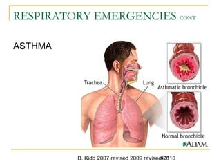 B. Kidd 2007 revised 2009 revised 2010401
RESPIRATORY EMERGENCIES CONT
ASTHMA
 