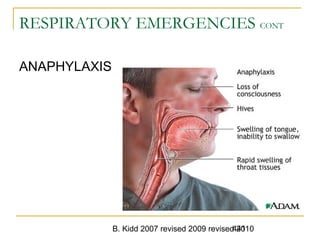 B. Kidd 2007 revised 2009 revised 2010441
RESPIRATORY EMERGENCIES CONT
ANAPHYLAXIS
 
