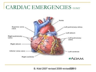 B. Kidd 2007 revised 2009 revised 2010515
CARDIAC EMERGENCIES CONT
 