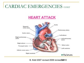 B. Kidd 2007 revised 2009 revised 2010544
CARDIAC EMERGENCIES CONT
HEART ATTACK
 