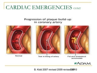 B. Kidd 2007 revised 2009 revised 2010549
CARDIAC EMERGENCIES CONT
 