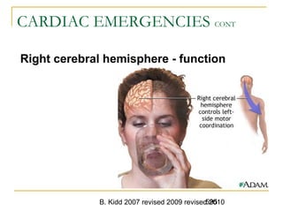 B. Kidd 2007 revised 2009 revised 2010595
CARDIAC EMERGENCIES CONT
Right cerebral hemisphere - function
 