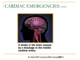 B. Kidd 2007 revised 2009 revised 2010597
CARDIAC EMERGENCIES CONT
 