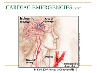 B. Kidd 2007 revised 2009 revised 2010598
CARDIAC EMERGENCIES CONT
 
