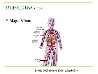 B. Kidd 2007 revised 2009 revised 2010643
BLEEDING CONT
 Major Veins
 