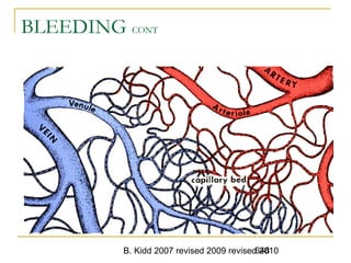 B. Kidd 2007 revised 2009 revised 2010648
BLEEDING CONT
 