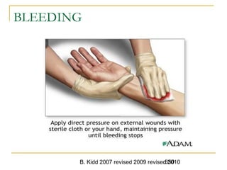 B. Kidd 2007 revised 2009 revised 2010650
BLEEDING
 