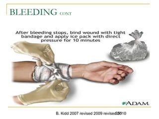 B. Kidd 2007 revised 2009 revised 2010651
BLEEDING CONT
 
