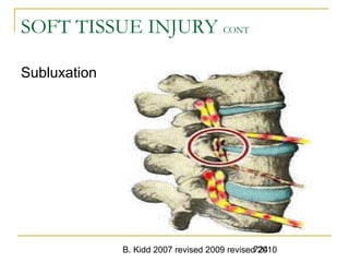 B. Kidd 2007 revised 2009 revised 2010724
SOFT TISSUE INJURY CONT
Subluxation
 