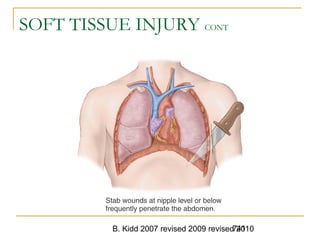 B. Kidd 2007 revised 2009 revised 2010741
SOFT TISSUE INJURY CONT
 