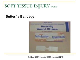 B. Kidd 2007 revised 2009 revised 2010802
SOFT TISSUE INJURY CONT
Butterfly Bandage
 