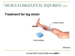 B. Kidd 2007 revised 2009 revised 2010863
MUSCULOSKELETAL INJURIES CONT
Treatment for leg strain
 