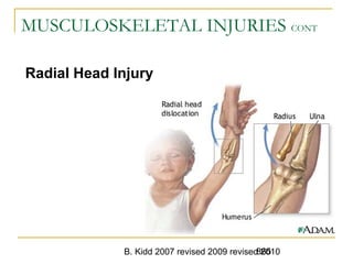 B. Kidd 2007 revised 2009 revised 2010865
MUSCULOSKELETAL INJURIES CONT
Radial Head Injury
 