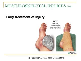 B. Kidd 2007 revised 2009 revised 2010881
MUSCULOSKELETAL INJURIES CONT
Early treatment of injury
 