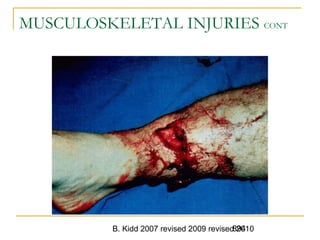 B. Kidd 2007 revised 2009 revised 2010894
MUSCULOSKELETAL INJURIES CONT
 