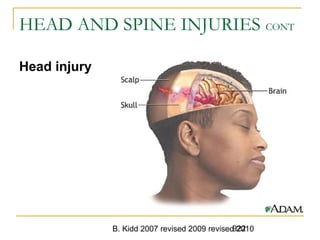 B. Kidd 2007 revised 2009 revised 2010922
HEAD AND SPINE INJURIES CONT
Head injury
 