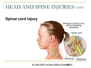 B. Kidd 2007 revised 2009 revised 2010962
HEAD AND SPINE INJURIES CONT
Spinal cord injury
 