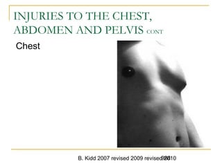 B. Kidd 2007 revised 2009 revised 2010988
INJURIES TO THE CHEST,
ABDOMEN AND PELVIS CONT
Chest
 