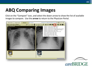 45


ABQ Comparing Images
Click on the “Compare” icon, and select the down arrow to show the list of available
images to compare. Use the arrow to return to the Physician Portal.
 