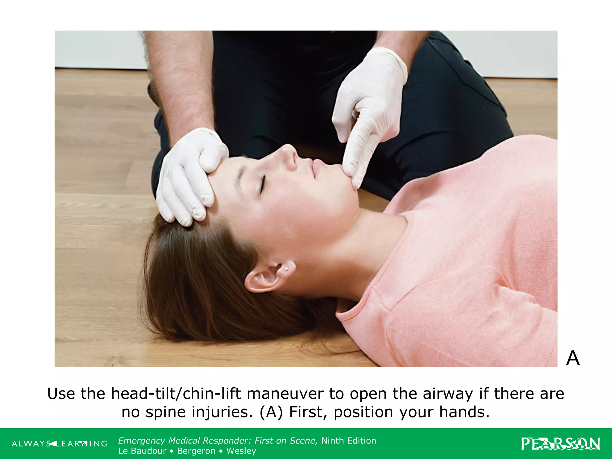 Copyright ©2012 by Pearson Education, Inc.
All rights reserved.
Emergency Care, Twelfth Edition
Daniel J. Limmer • O’Keefe • Grant • Murray • Bergeron • Dickinson
Emergency Medical Responder: First on Scene, Ninth Edition
Le Baudour • Bergeron • Wesley
Use the head-tilt/chin-lift maneuver to open the airway if there are
no spine injuries. (A) First, position your hands.
A
 