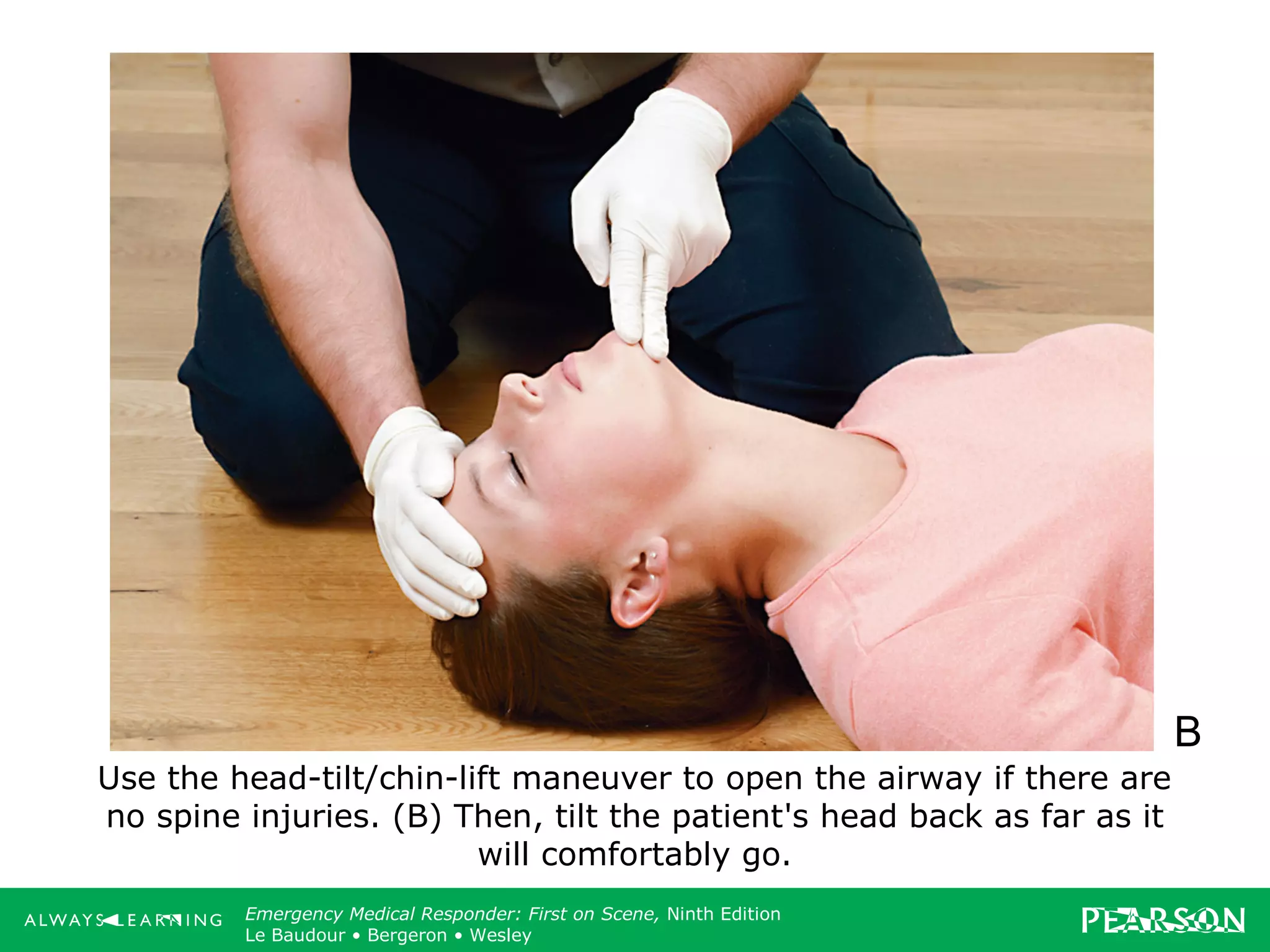 Copyright ©2012 by Pearson Education, Inc.
All rights reserved.
Emergency Care, Twelfth Edition
Daniel J. Limmer • O’Keefe • Grant • Murray • Bergeron • Dickinson
Emergency Medical Responder: First on Scene, Ninth Edition
Le Baudour • Bergeron • Wesley
Use the head-tilt/chin-lift maneuver to open the airway if there are
no spine injuries. (B) Then, tilt the patient's head back as far as it
will comfortably go.
B
 