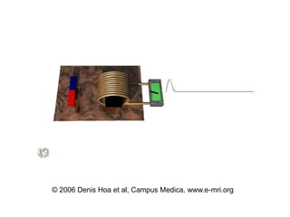 © 2006 Denis Hoa et al, Campus Medica. www.e-mri.org
 