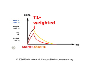 © 2006 Denis Hoa et al, Campus Medica. www.e-mri.org
 