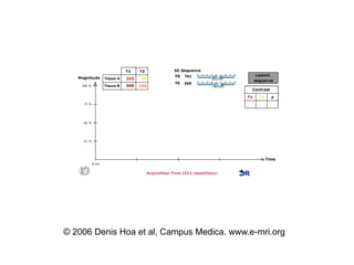 © 2006 Denis Hoa et al, Campus Medica. www.e-mri.org
 