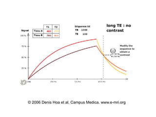 © 2006 Denis Hoa et al, Campus Medica. www.e-mri.org
 