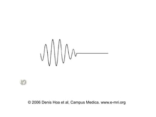 © 2006 Denis Hoa et al, Campus Medica. www.e-mri.org
 