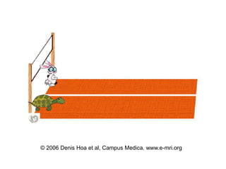 © 2006 Denis Hoa et al, Campus Medica. www.e-mri.org
 