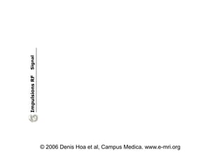 © 2006 Denis Hoa et al, Campus Medica. www.e-mri.org
 