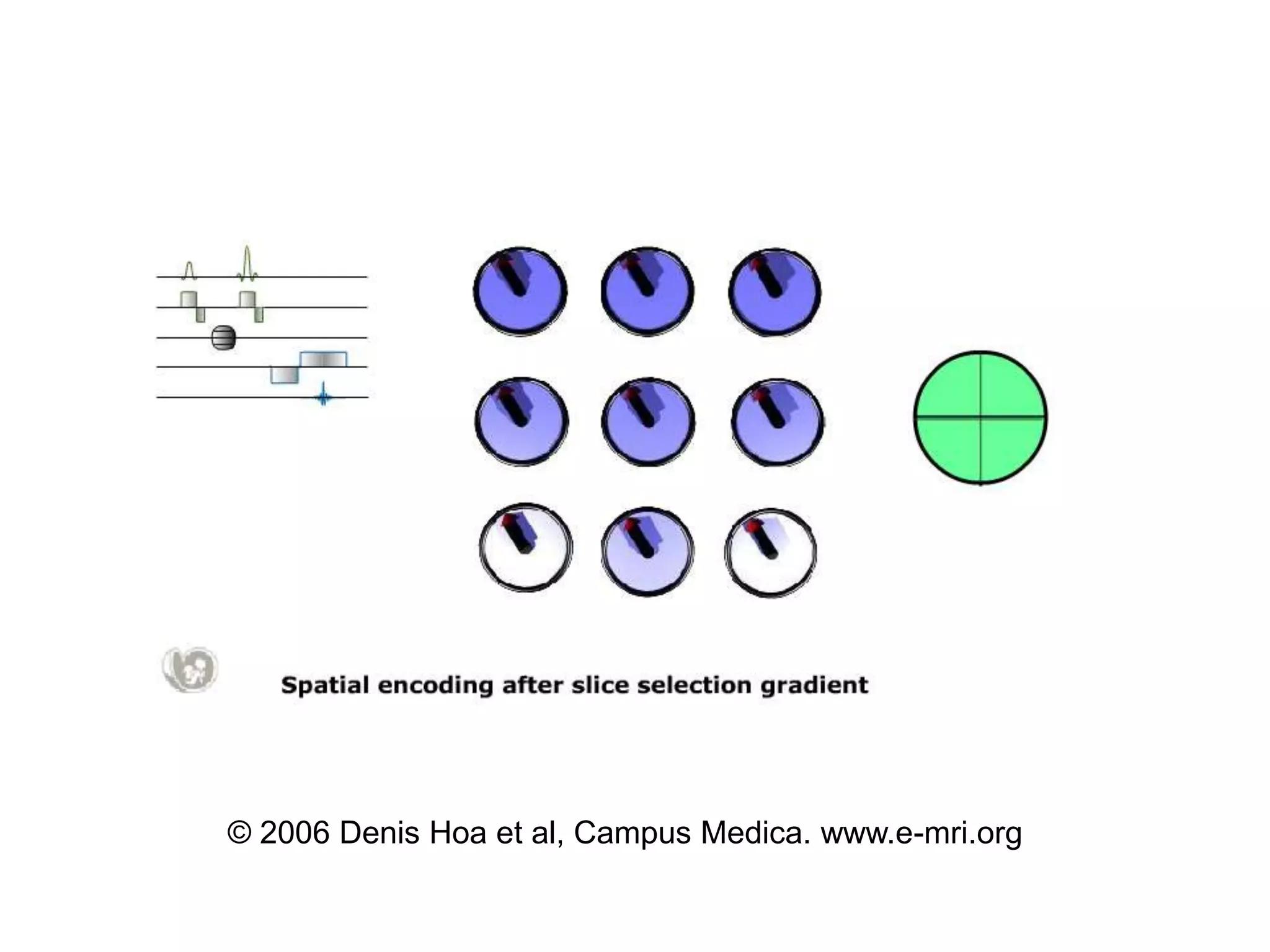 E mri spatialencoding_slides | PPT