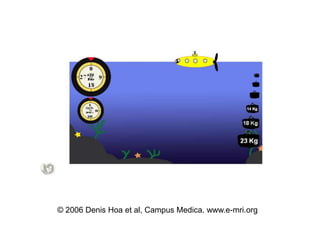 ? 2006 Denis Hoa et al, Campus Medica. www.e-mri.org
 