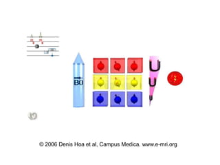 ? 2006 Denis Hoa et al, Campus Medica. www.e-mri.org
 